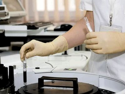 В Нижегородской области подтверждено еще 153 случая заражения коронавирусом
