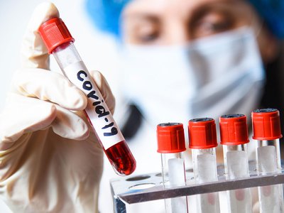 Тесты на коронавирус в Нижегородской области сдали уже более 152 тысяч жителей